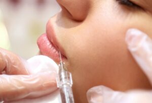 What are dermal fillers